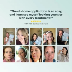 Newyuo® hydrating, moisturizing, anti-wrinkle, firming micro needles