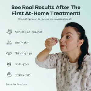 Newyuo® hydrating, moisturizing, anti-wrinkle, firming micro needles