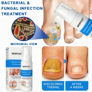 💥 Psoriasis, Eczema, or Genital Itch? Newyuo® Magnesium Herbal Spray Clears It All — MHRA Approved Formula!