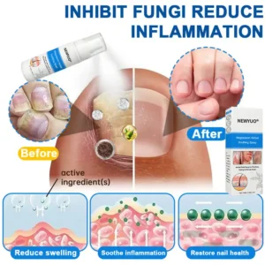 💥 Psoriasis, Eczema, or Genital Itch? Newyuo® Magnesium Herbal Spray Clears It All — MHRA Approved Formula!