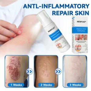 💥 Psoriasis, Eczema, or Genital Itch? Newyuo® Magnesium Herbal Spray Clears It All — MHRA Approved Formula!