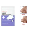 Newyuo™ Nose Pore Patches for Pores & Pimples | Medical-Grade Hydrocolloid (Buy 1 Get 1 Free)
