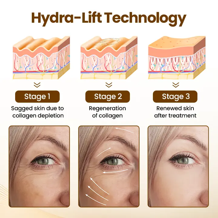 Last Day 70% OFF-Newyuo® Renewing 10s Wrinkle Serum