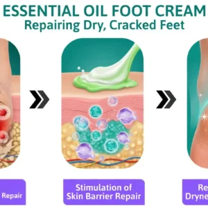 🎁 NEWYUO™ Limited-Time Offer 🎁 - Don't miss out!Tea Tree Oil Foot Cream (Repairs Dry Cracked Heels, Soothes Tired Feet, Eliminates Odor & Restores Soft Skin)