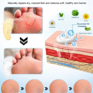 🎁 NEWYUO™ Limited-Time Offer 🎁 - Don't miss out!Tea Tree Oil Foot Cream (Repairs Dry Cracked Heels, Soothes Tired Feet, Eliminates Odor & Restores Soft Skin)