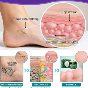 🎁 NEWYUO™ Limited-Time Offer 🎁 - Don't miss out!Tea Tree Oil Foot Cream (Repairs Dry Cracked Heels, Soothes Tired Feet, Eliminates Odor & Restores Soft Skin)